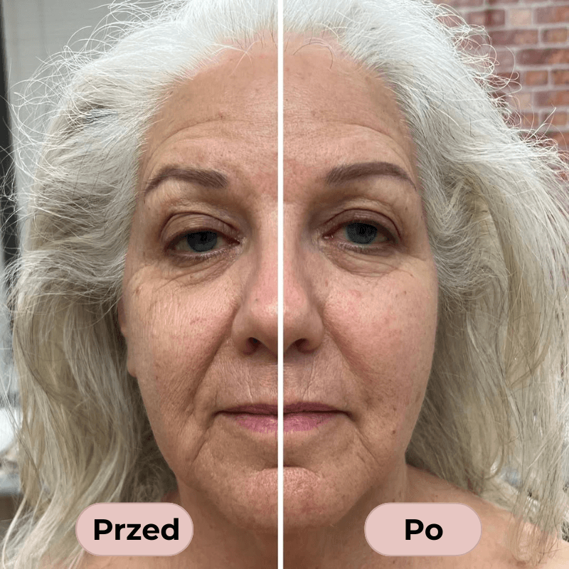 LumiBrush- smuklejsza twarz już po pierwszym użyciu!